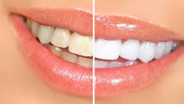 Cosmetic Dentistry