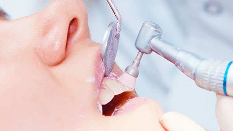 Gum Disease Prevention